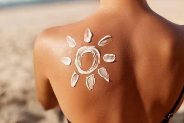 Sunčanica i 8 načina kako se zaštititi na plaži